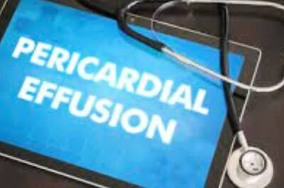 Symptoms To Cause: Here’s All You Need To Know About Pericardial Effusion
