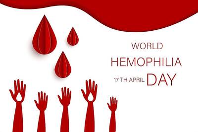 World Hemophilia Day 2021: Theme, History and Significance