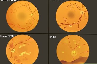 How to Treat Diabetic Retinopathy
