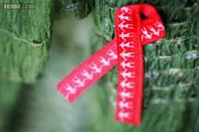 Scientists find mechanism for spontaneous HIV cure