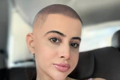 Urfi Javed Goes BALD? Actress Shares Bold Pic With No Hair, Shocked Fans Spot The Truth