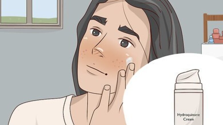 How to Get Rid of Acne Scars Naturally