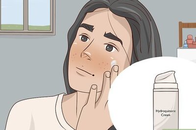 How to Get Rid of Acne Scars Naturally