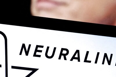 Neuralink's First Brain Chip Implant Faces Hurdle After 100 Days Of Clinical Trial