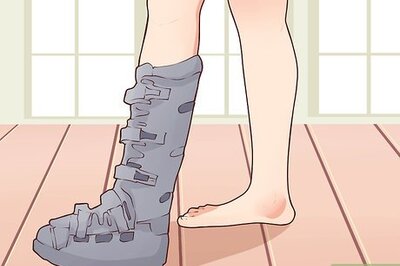 How to Recover From Plantar Fasciitis Surgery