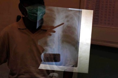 Health Ministry Looks to Criminalise Non-reporting of Tuberculosis Cases