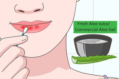 How to Heal Sunburned Lips