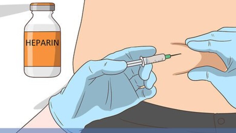 How to Treat DVT in Your Arm