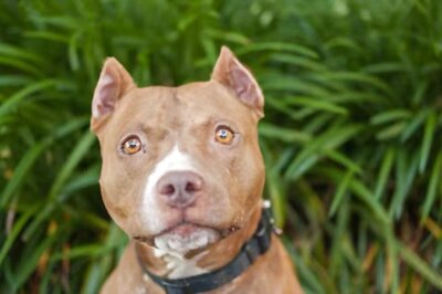 Trauma To Triumph, Woman Shares Journey After Dog Attack And Reconstructive Surgeries