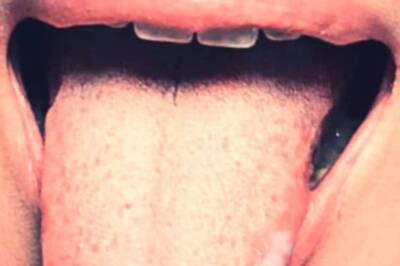 AI Tongue Analysis Diagnoses Health Conditions With 98% Accuracy, New Study Reveals