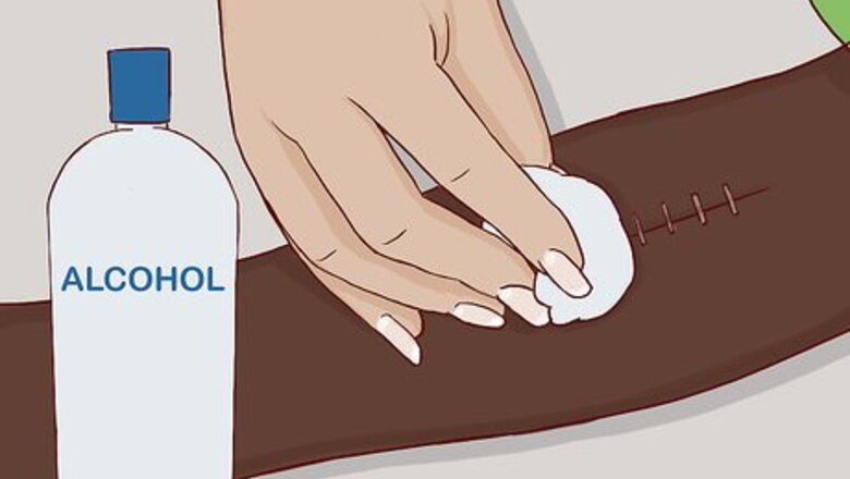 How to Remove Surgical Staples