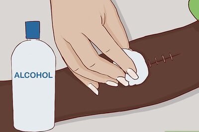 How to Remove Surgical Staples