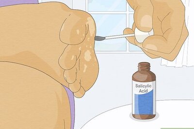 How to Get Rid of a Mosaic Wart