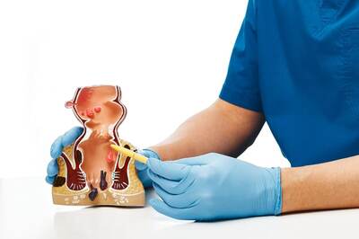 Anal Cancer: All You Need To Know About Symptoms, Causes And Treatment