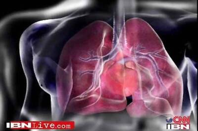 Robotic assisted surgery ushering in new era in heart surgery