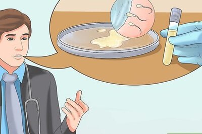 How to Prevent HIV Infection