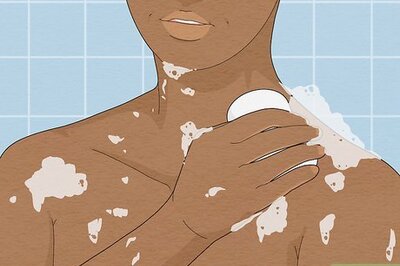 How to Get Rid of Onion-Smelling Body Odor