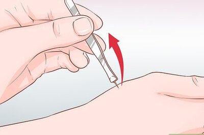 How to Take Care of a Wasp Sting