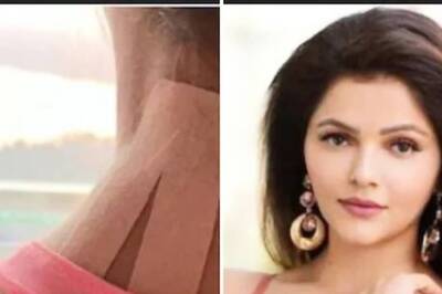 Rubina Dilaik Suffers Shoulder Injury, Shares Picture on Instagram