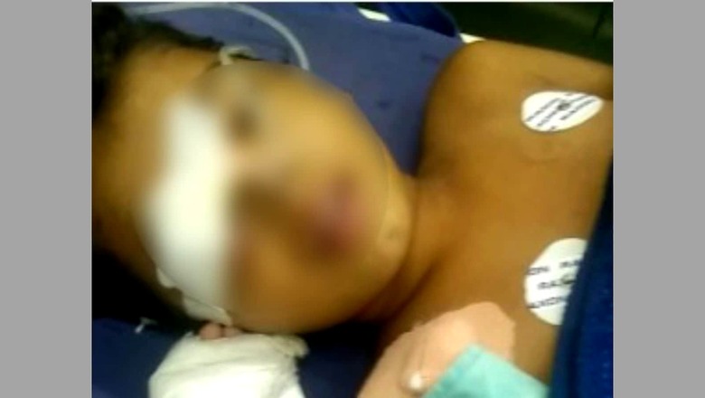 Beaten by Teacher For Touching Water Pot, Dalit Boy Dies of Injuries in Raj's Jalore; Internet Cut in Area
