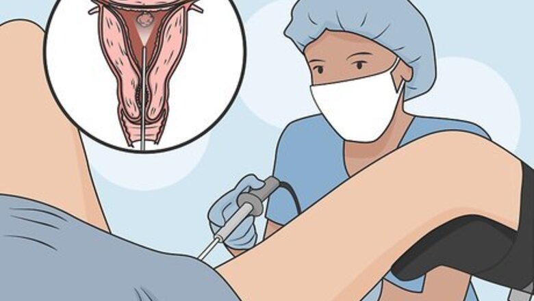How to Remove Uterine Polyps