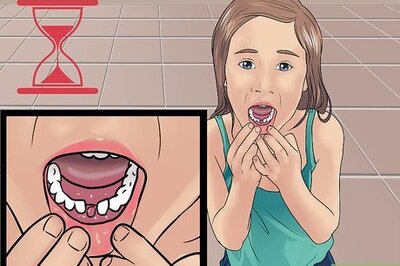 How to Stop the Bleeding After You Pull out a Loose Tooth