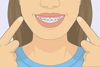 How to Smile With Braces