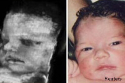 Exposure to chemicals harmful for unborn