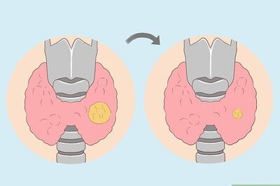 How to Take Lugol's Iodine Orally
