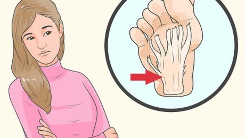 How to Avoid Heel Pain and Plantar Fasciitis