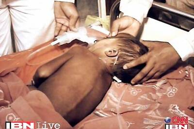 24 children die of Japanese Encephalitis in Odisha