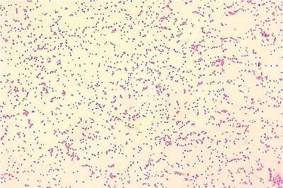 Brucellosis Outbreak in China: Here's Why India Needs to be Cautious on Time