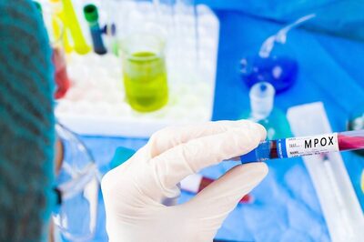 Mpox May Not be as Deadly as Covid-19, But Complacency Not An Option: Experts to News18