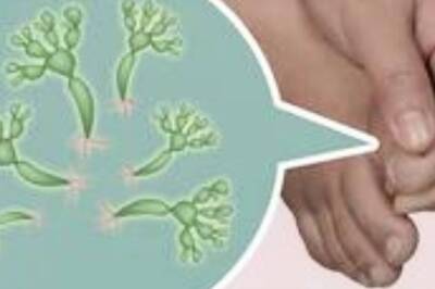 Diet, Lifestyle Changes to Prevent Fungal Skin Infections Naturally