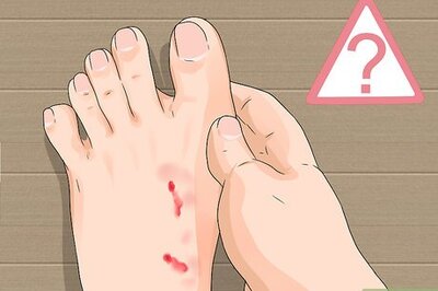 How to Know if a Pet Bite Is Serious