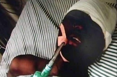 Yannick’s family refused to shift him to PGI