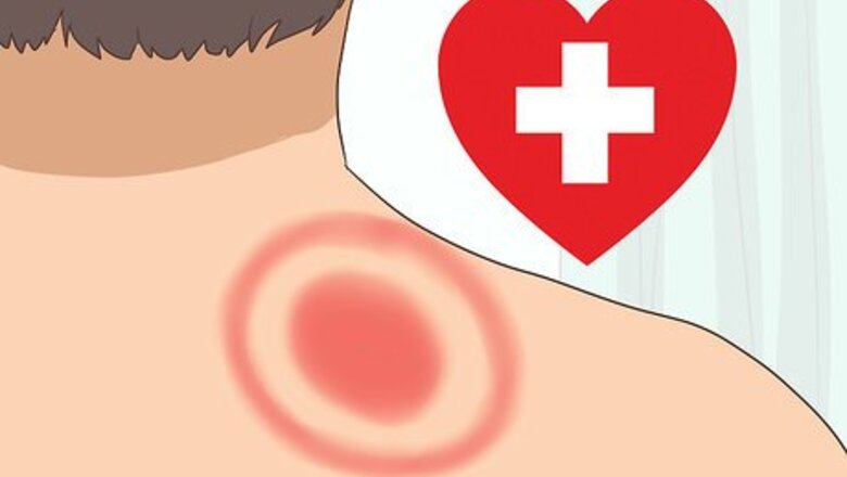 How to Beat Lyme Disease
