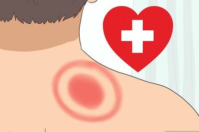 How to Beat Lyme Disease