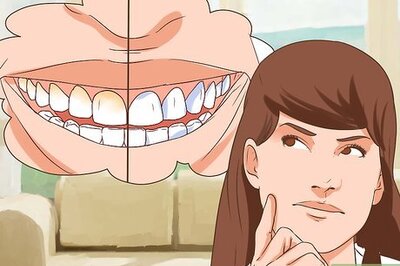 How to Choose a Cosmetic Dentist