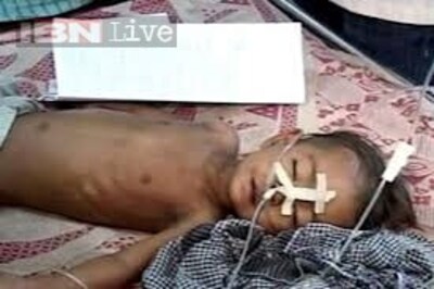 Assam government steps up measures to combat encephalitis