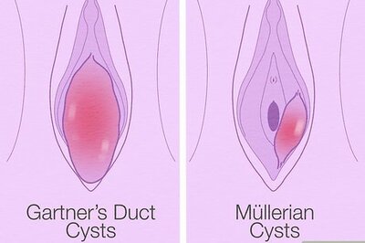 How to Get Rid of a Skene’s Gland Vaginal Cyst