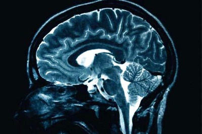 Brain surgery saved Russian general who helped defeat Napoleon