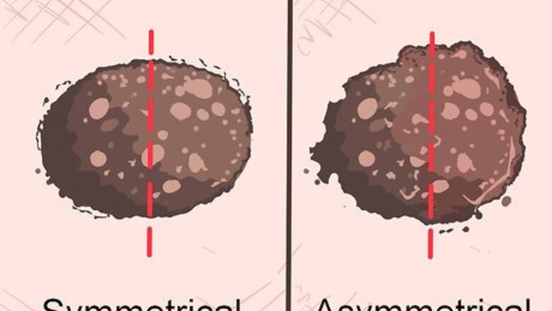 How to Recognize Melanoma