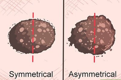 How to Recognize Melanoma