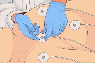 How to Become an ECG Technician