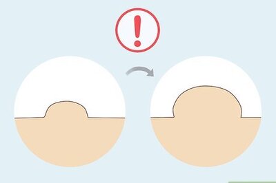 How to Dissolve Nodules: Can Natural Remedies Help?