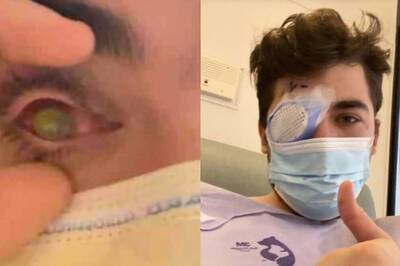 Flesh-Eating Parasites Feed On a Man’s Eye After He Sleeps with Contact Lenses On