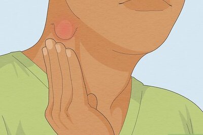 How to Treat Swollen Lymph Nodes in Neck: Natural Treatments, & More