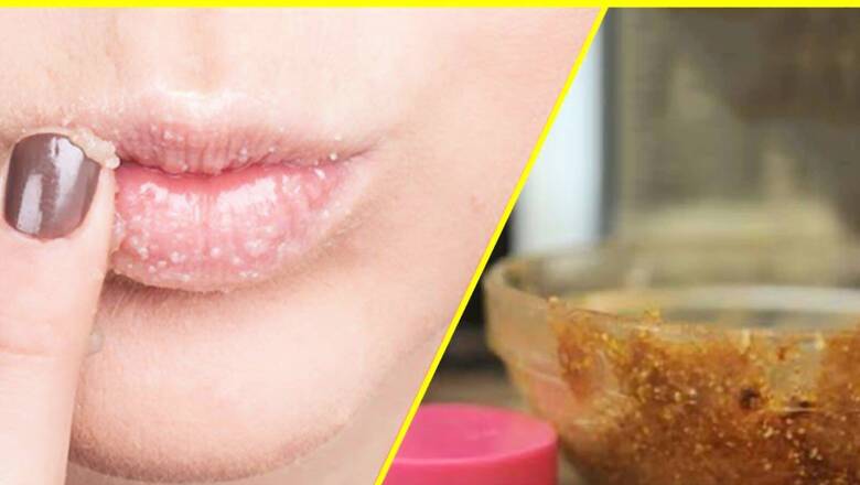 DIY Scrubs You Must Try Right Away For Plump and Healthy Lips