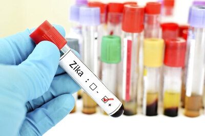 News18 Daybreak | MJ Akbar Rebuffs #MeToo Allegations, Zika Virus Scare in Jaipur and Other Stories You May Have Missed